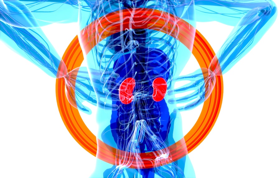 petrochemical spine risk